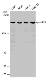 Anti-RIF1 antibody used in Western Blot (WB). GTX131787