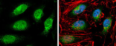 Anti-RIF1 antibody used in Immunocytochemistry/ Immunofluorescence (ICC/IF). GTX131787