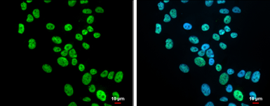Anti-KHSRP antibody used in Immunocytochemistry/ Immunofluorescence (ICC/IF). GTX131804