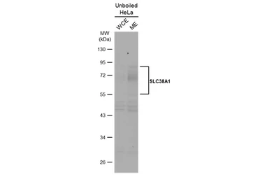 Anti-SLC38A1 antibody used in Western Blot (WB). GTX131854