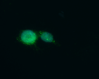 Anti-MED10 antibody used in Immunocytochemistry/ Immunofluorescence (ICC/IF). GTX131860