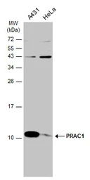 Anti-PRAC1 antibody used in Western Blot (WB). GTX131861