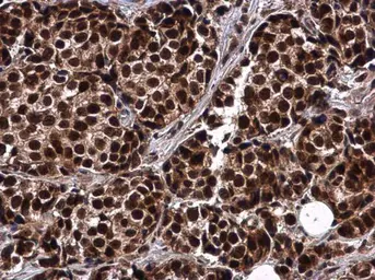 Anti-RIF1 antibody used in IHC (Paraffin sections) (IHC-P). GTX131889