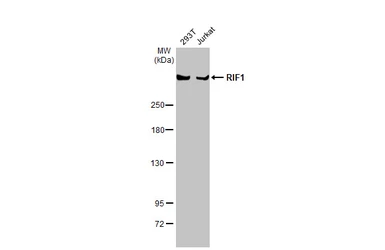 Anti-RIF1 antibody used in Western Blot (WB). GTX131889