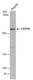 Anti-CEP192 antibody used in Western Blot (WB). GTX131891