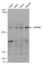 Anti-CEP192 antibody used in Western Blot (WB). GTX131892