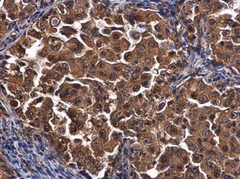 Anti-CEP192 antibody used in IHC (Paraffin sections) (IHC-P). GTX131892