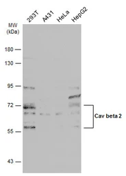 Anti-Cav beta 2 antibody used in Western Blot (WB). GTX131906