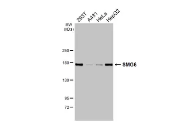 Anti-SMG6 antibody used in Western Blot (WB). GTX131919