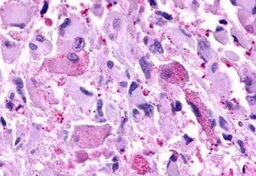 Anti-mGluR2 antibody used in IHC (Paraffin sections) (IHC-P). GTX13192