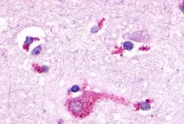 Anti-mGluR2 antibody used in IHC (Paraffin sections) (IHC-P). GTX13192