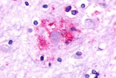 Anti-mGluR2 antibody used in IHC (Paraffin sections) (IHC-P). GTX13192