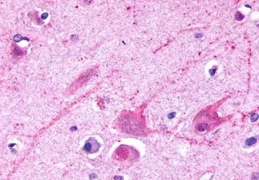 Anti-mGluR2 antibody used in IHC (Paraffin sections) (IHC-P). GTX13192
