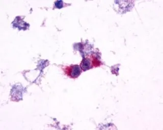 Anti-mGluR2 antibody used in Immunocytochemistry/ Immunofluorescence (ICC/IF). GTX13192