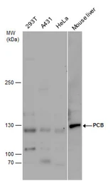 Anti-Pyruvate Carboxylase antibody used in Western Blot (WB). GTX131987