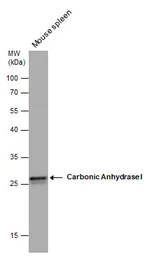 Anti-Carbonic Anhydrase 1 antibody used in Western Blot (WB). GTX132070