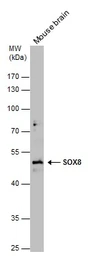 Anti-SOX8 antibody used in Western Blot (WB). GTX132075