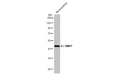 Anti-BMP7 antibody used in Western Blot (WB). GTX132085
