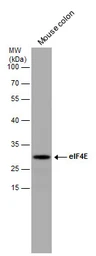 Anti-eIF4E antibody used in Western Blot (WB). GTX132092
