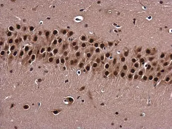 Anti-BARD1 antibody used in IHC (Paraffin sections) (IHC-P). GTX132094