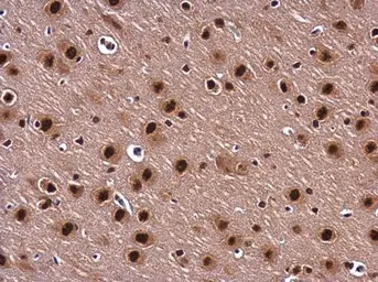 Anti-BARD1 antibody used in IHC (Paraffin sections) (IHC-P). GTX132094
