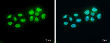 Anti-BARD1 antibody used in Immunocytochemistry/ Immunofluorescence (ICC/IF). GTX132094