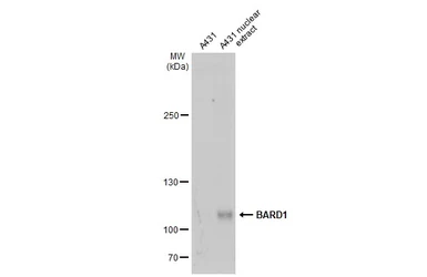 Anti-BARD1 antibody used in Western Blot (WB). GTX132094
