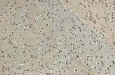 Anti-BARD1 antibody used in IHC (Paraffin sections) (IHC-P). GTX132094