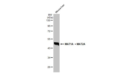 Anti-MAT1A + MAT2A antibody used in Western Blot (WB). GTX132095