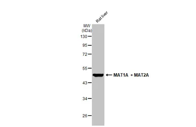 Anti-MAT1A + MAT2A antibody used in Western Blot (WB). GTX132095
