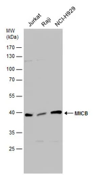 Anti-MICB antibody used in Western Blot (WB). GTX132112