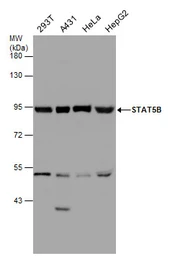 Anti-STAT5B antibody used in Western Blot (WB). GTX132113