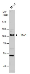 Anti-RAG1 antibody used in Western Blot (WB). GTX132124