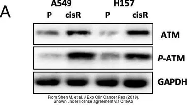 Anti-ATM (phospho Ser1981) antibody used in Western Blot (WB). GTX132146