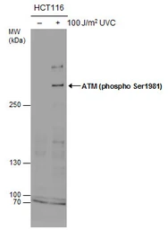 Anti-ATM (phospho Ser1981) antibody used in Western Blot (WB). GTX132146