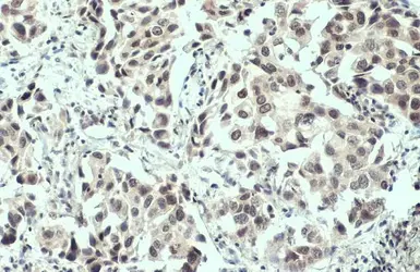 Anti-ATM (phospho Ser1981) antibody used in IHC (Paraffin sections) (IHC-P). GTX132146