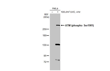 Anti-ATM (phospho Ser1981) antibody used in Western Blot (WB). GTX132146
