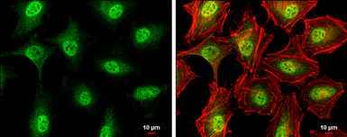 Anti-ATM antibody used in Immunocytochemistry/ Immunofluorescence (ICC/IF). GTX132147