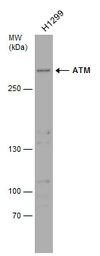 Anti-ATM antibody used in Western Blot (WB). GTX132147
