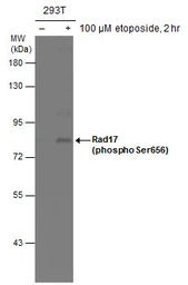 Anti-Rad17 (phospho Ser656) antibody used in Western Blot (WB). GTX132150
