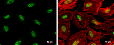 Anti-Rad17 (phospho Ser656) antibody used in Immunocytochemistry/ Immunofluorescence (ICC/IF). GTX132150