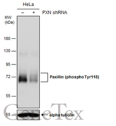 Anti-Paxillin (phospho Tyr118) antibody used in Western Blot (WB). GTX132152
