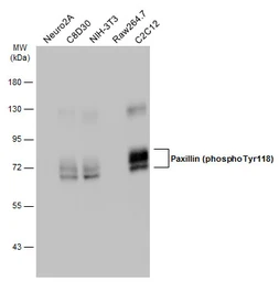 Anti-Paxillin (phospho Tyr118) antibody used in Western Blot (WB). GTX132152