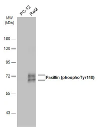 Anti-Paxillin (phospho Tyr118) antibody used in Western Blot (WB). GTX132152