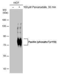 Anti-Paxillin (phospho Tyr118) antibody used in Western Blot (WB). GTX132152
