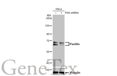 Anti-Paxillin antibody used in Western Blot (WB). GTX132153