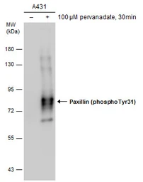Anti-Paxillin (phospho Tyr31) antibody used in Western Blot (WB). GTX132154