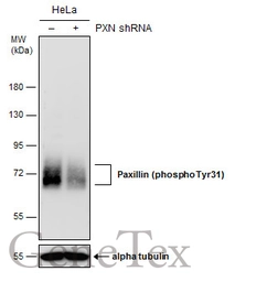Anti-Paxillin (phospho Tyr31) antibody used in Western Blot (WB). GTX132154