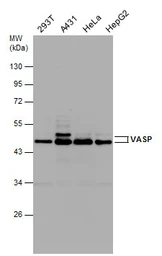 Anti-VASP antibody used in Western Blot (WB). GTX132176