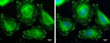 Anti-VASP antibody used in Immunocytochemistry/ Immunofluorescence (ICC/IF). GTX132176